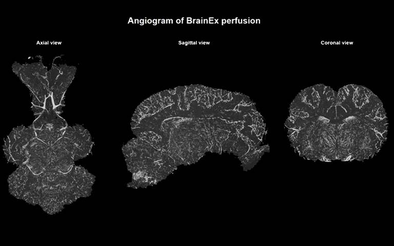 Resultado de imagen para reviven cerebro de cerdos