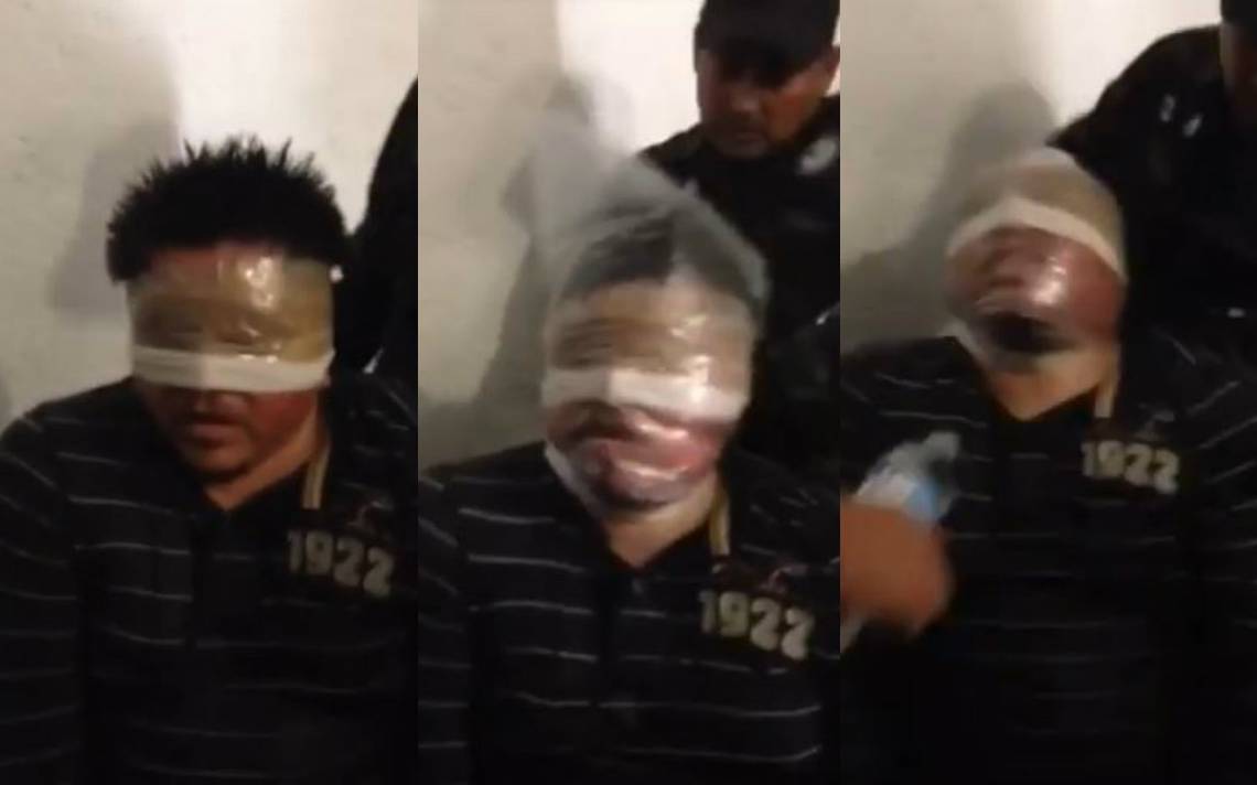 Revelan Tortura Contra Presunto Implicado En Desaparición De Los 43 De